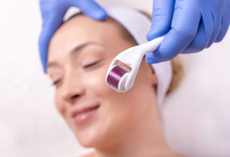 woman having micro-needling